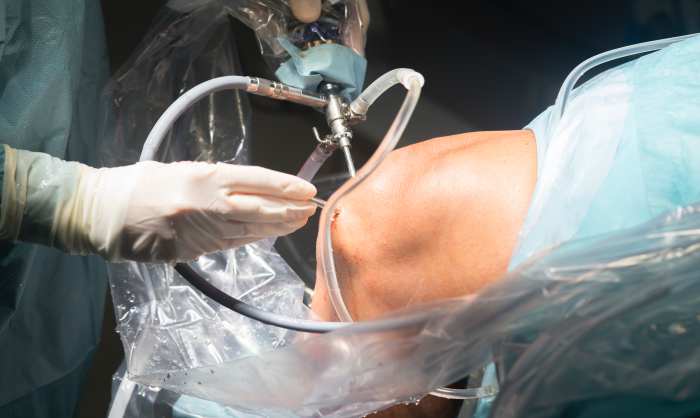 Knee arthroscopy | knee surgeon Perth